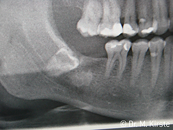 W&H X-Ray
