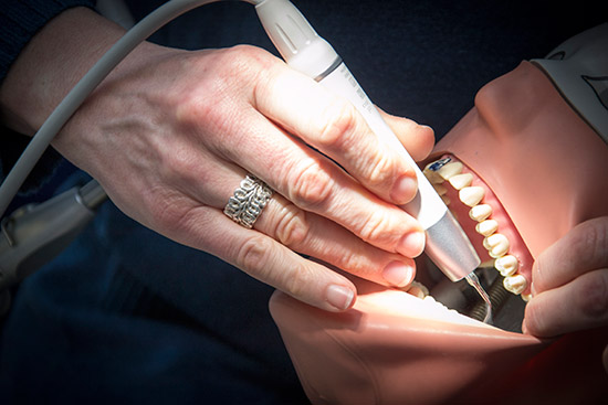  Die W&H Piezo Scaler Spitzen im Test.  