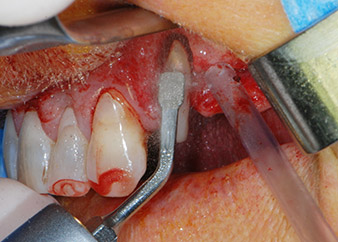 periodontium 