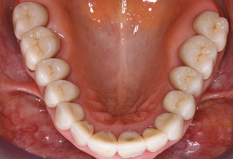 Fig. 11a
