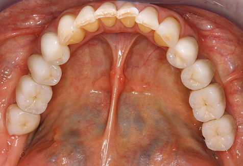 Fig. 11b