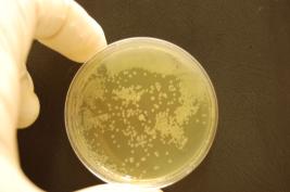 Ozone 1 * 24 sec. (after 1,5h)