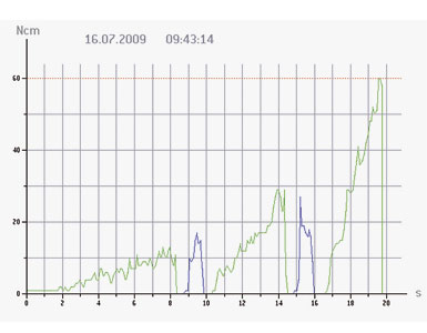 //a.storyblok.com/f/45617/5faa0cb11b/elcomed-torque-recording_overlay.jpg