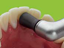 //a.storyblok.com/f/45617/60239746ed/polishing-composite-frontal.png