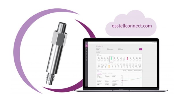 OsstellConnect