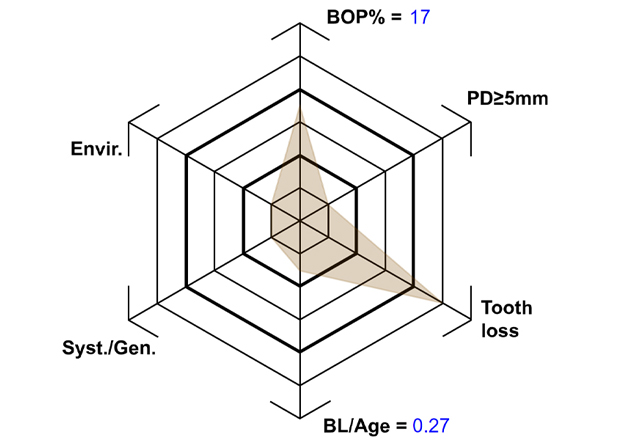 Case presentation: Complex Dental Prosthesis Management