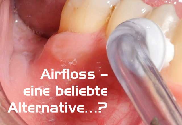 Airfloss – eine beliebte Alternative …?