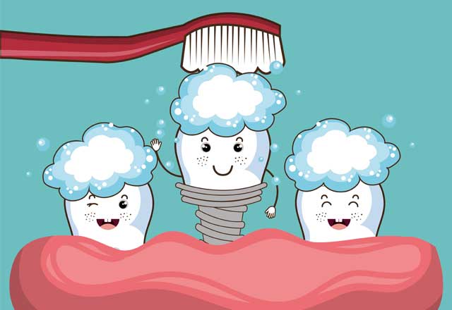 Ist die Pflege der Implantate wichtig?