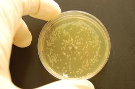 Ozone 1 * 24 sec. (immediate)