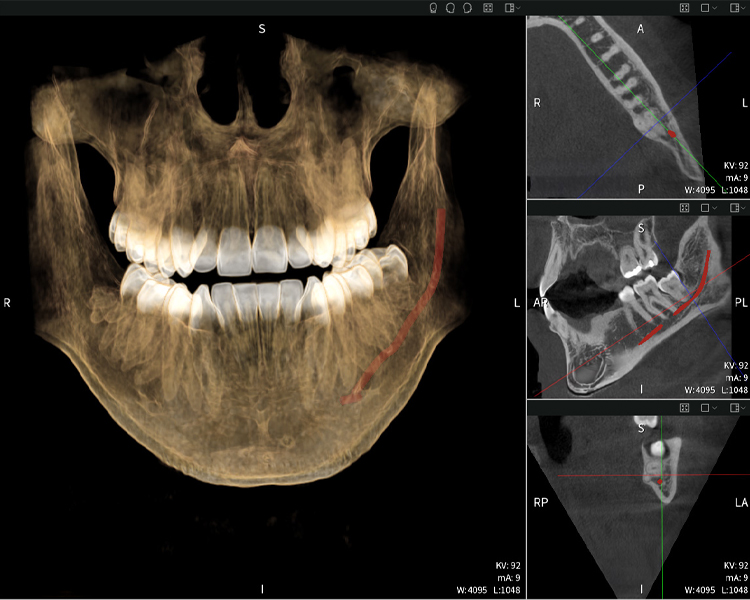 Figure d: Imaging results of Seethrough Max, in front of a black background.