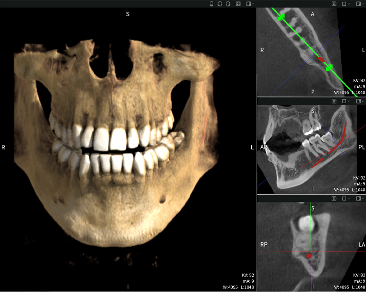 Figure c: Imaging results of Seethrough Max, in front of a black background.