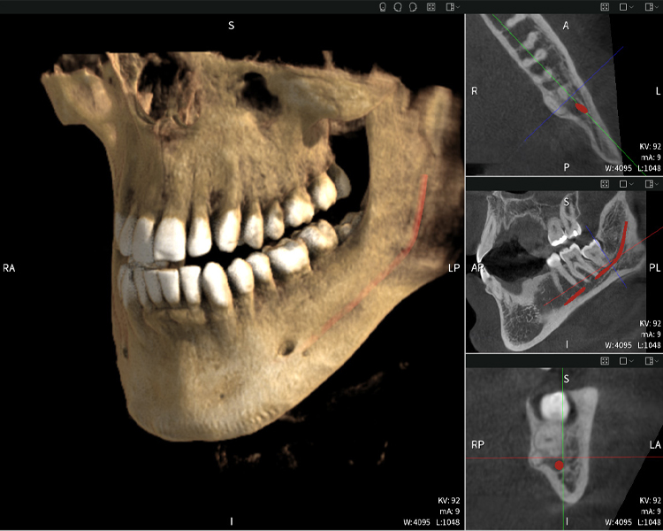 Figure b: Imaging results of Seethrough Max, in front of a black background.