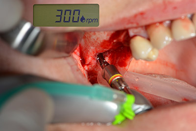 Perforazione inclinata