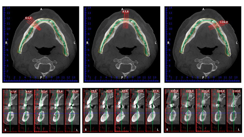 Fast & Fixed-Methode 