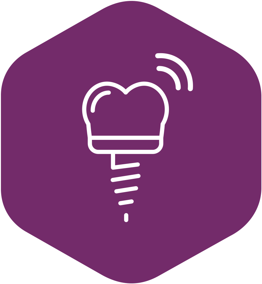 Determinazione della stabilità implantare