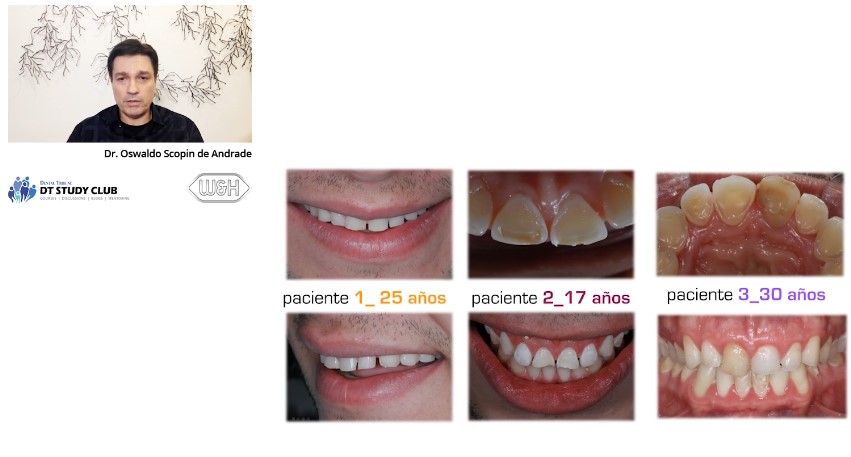 DT Study Club - Dr. Oswaldo Scopin