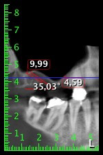 W&H Implantmed