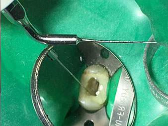 Strumento piezoelettrico 1E