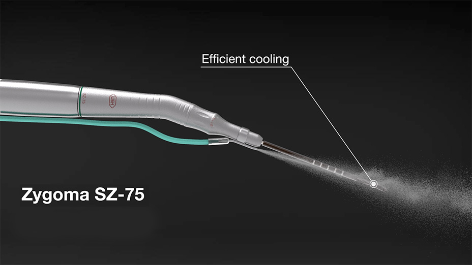 いのまさ zygoma-360-thumb.jpg?t=1761081886