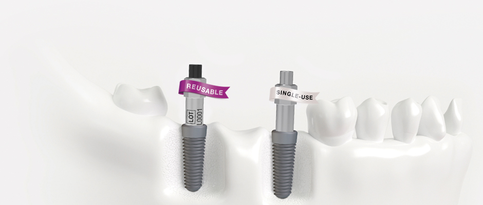 Reusable and single-use SmartPegs by Osstell in a denture, with a purple flag indicating "reusable" and a white flag indicating "single-use".