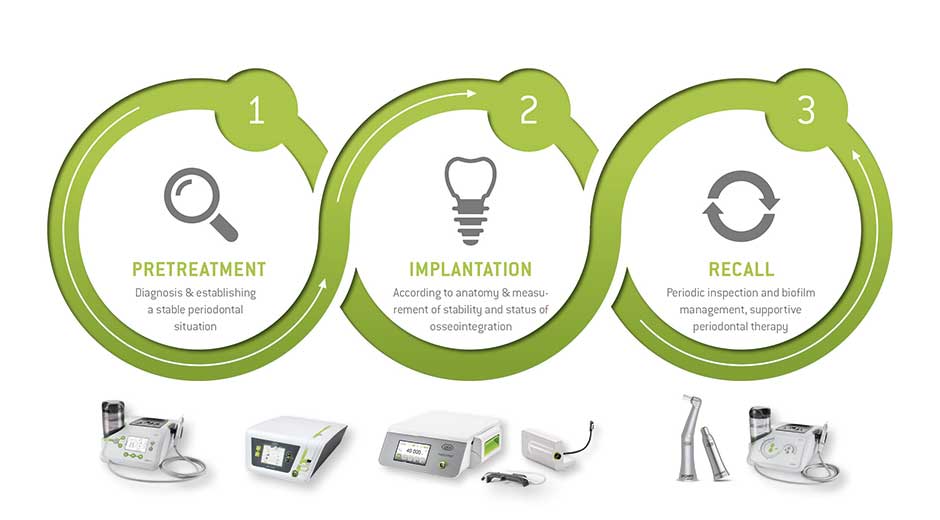 The evidence-based, systematic NIWOP workflow contributes to lasting implant success.