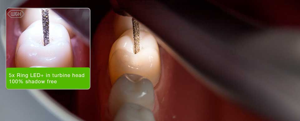 led-comparison-sirona.jpg?t=