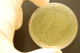 Ozone 1 * 24 sec. (after 1,5 h)