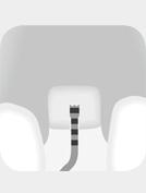 I2A, I2P, I3A, I3P I2A, I2P, I3A, I3P