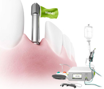 Implantmed