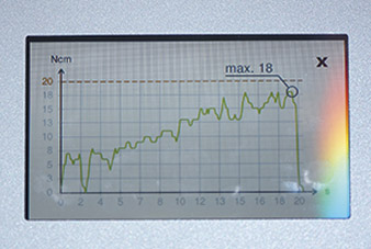 Monitoring the torque progression with Implantmed