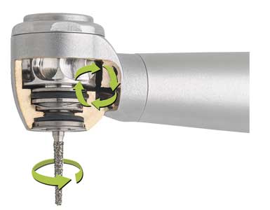 //a.storyblok.com/f/45617/b31f787996/alegra-turbine_hygiene-head-system_overlay.jpg
