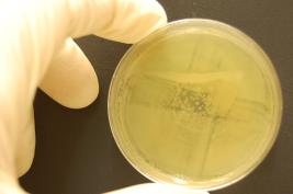 Ozon 1* 24 Sek. (nach 1,5 h)