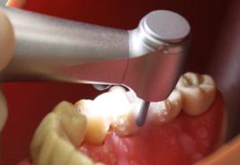 Alegra contra-angle handpiece