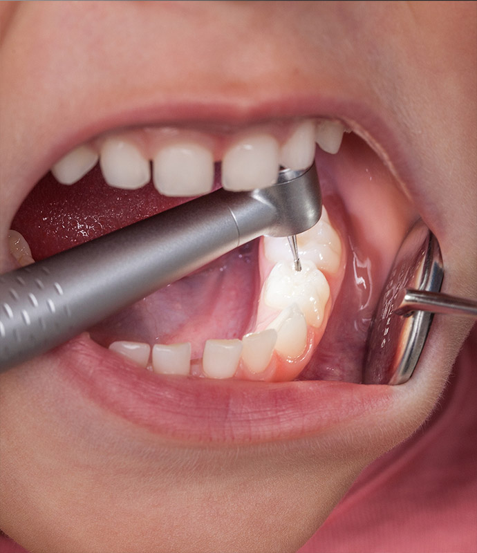 minimalinvasive Eingriffe