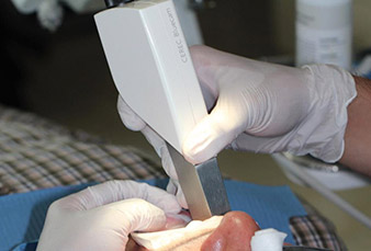 Digitale Abformung mit einem Intraoralscanner