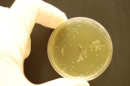 Ozon 3 * 24 Sek. (nach 1,5 h)