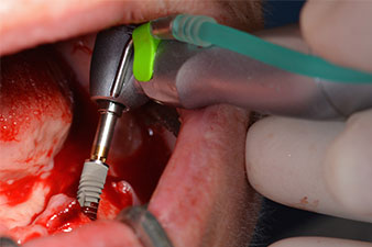 W&H обратен наконечник