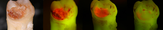//a.storyblok.com/f/45617/f02de62205/facelight-minimally-invasive.jpg