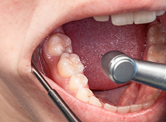 Synea Vision