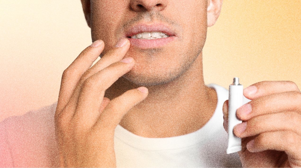 Профилактика герпеса: как избежать повторных вспышек