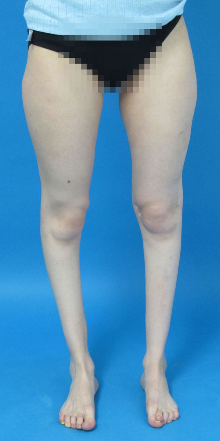 Behandlungsergebnis
