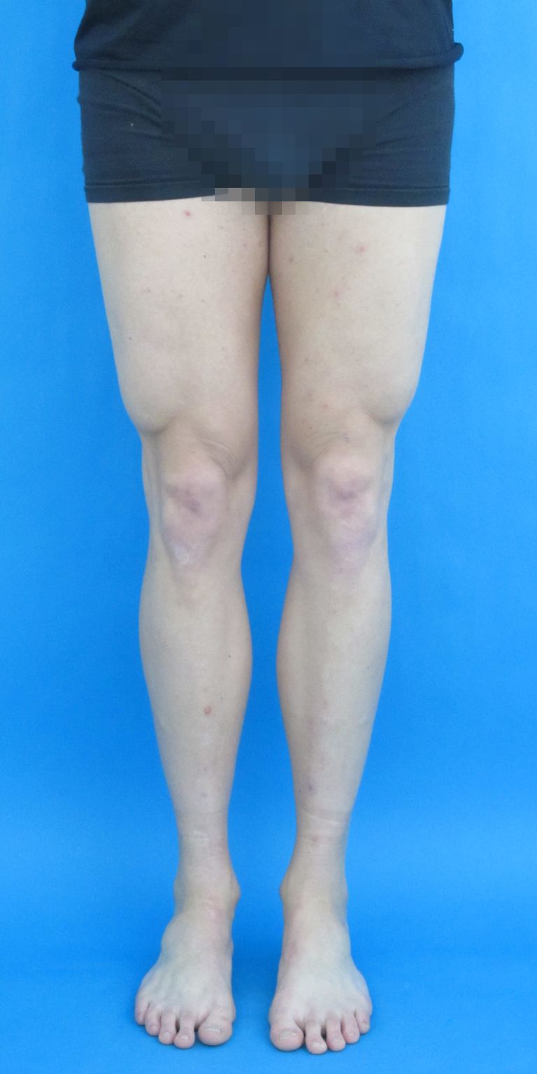 Treatment completion