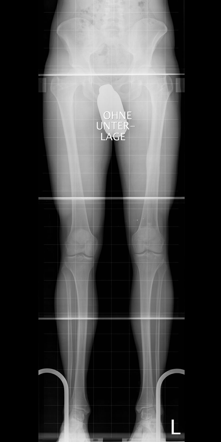 Equal length straight legs