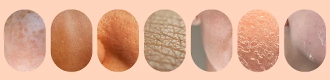 7 images of different skin textures on an orange background.