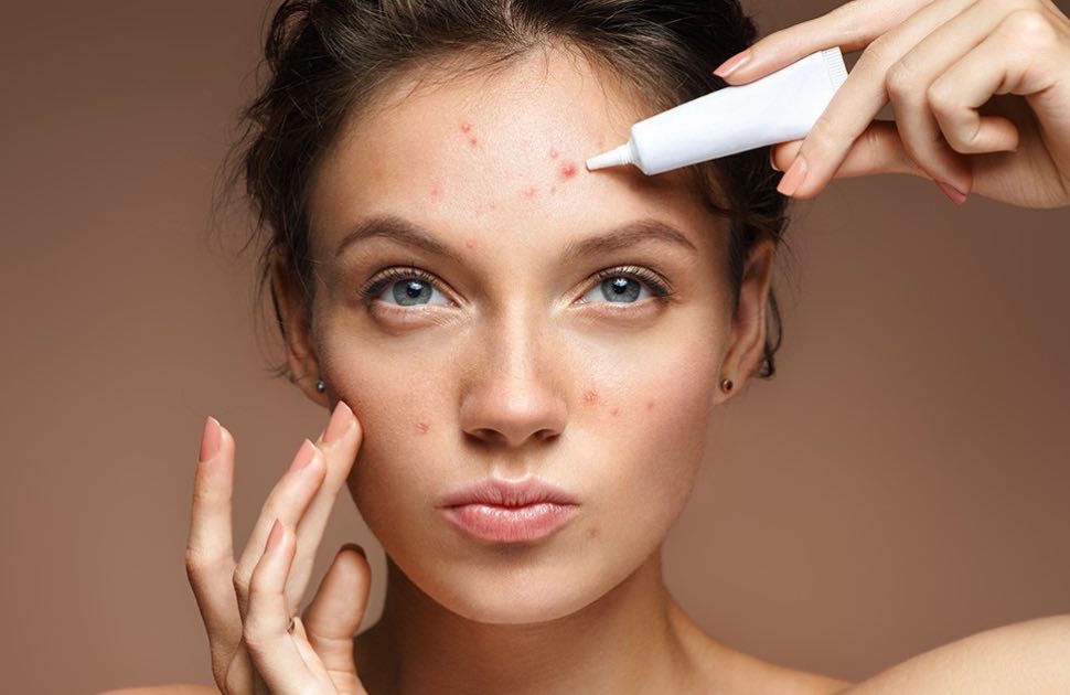 Australian Skin Clinics solutions for Acne Scars