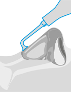 Illustration of the MR3 tip, in front of a grey background.