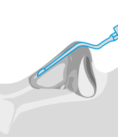 Illustration of the MR6 tip in front of a white background.