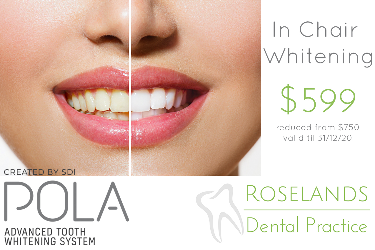 Teeth Whitening $599 Special Offer