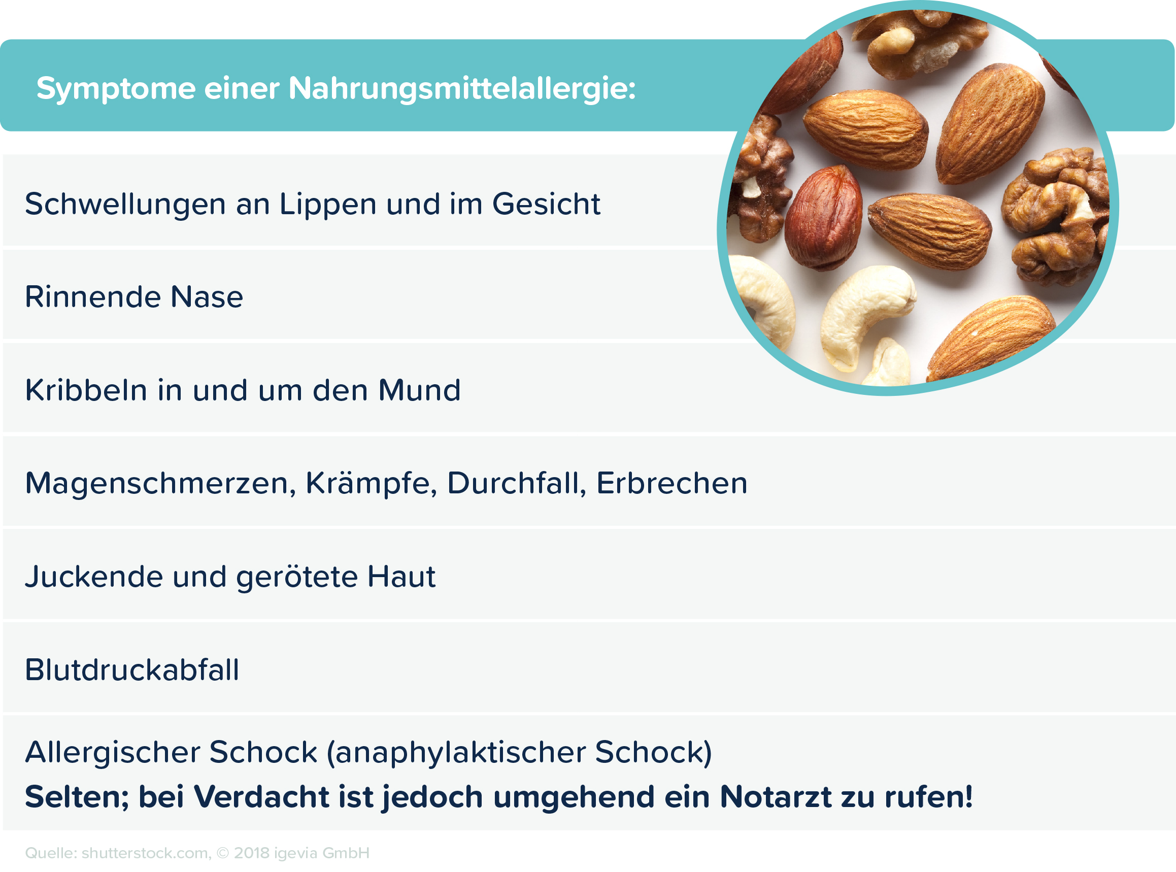 Allergien bei Kindern igevia