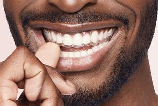 Man wearing clear aligners